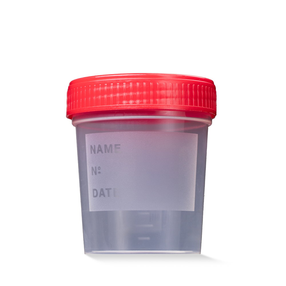 PP Urine collection container with screw cap, 125 ml, colour transparent, red